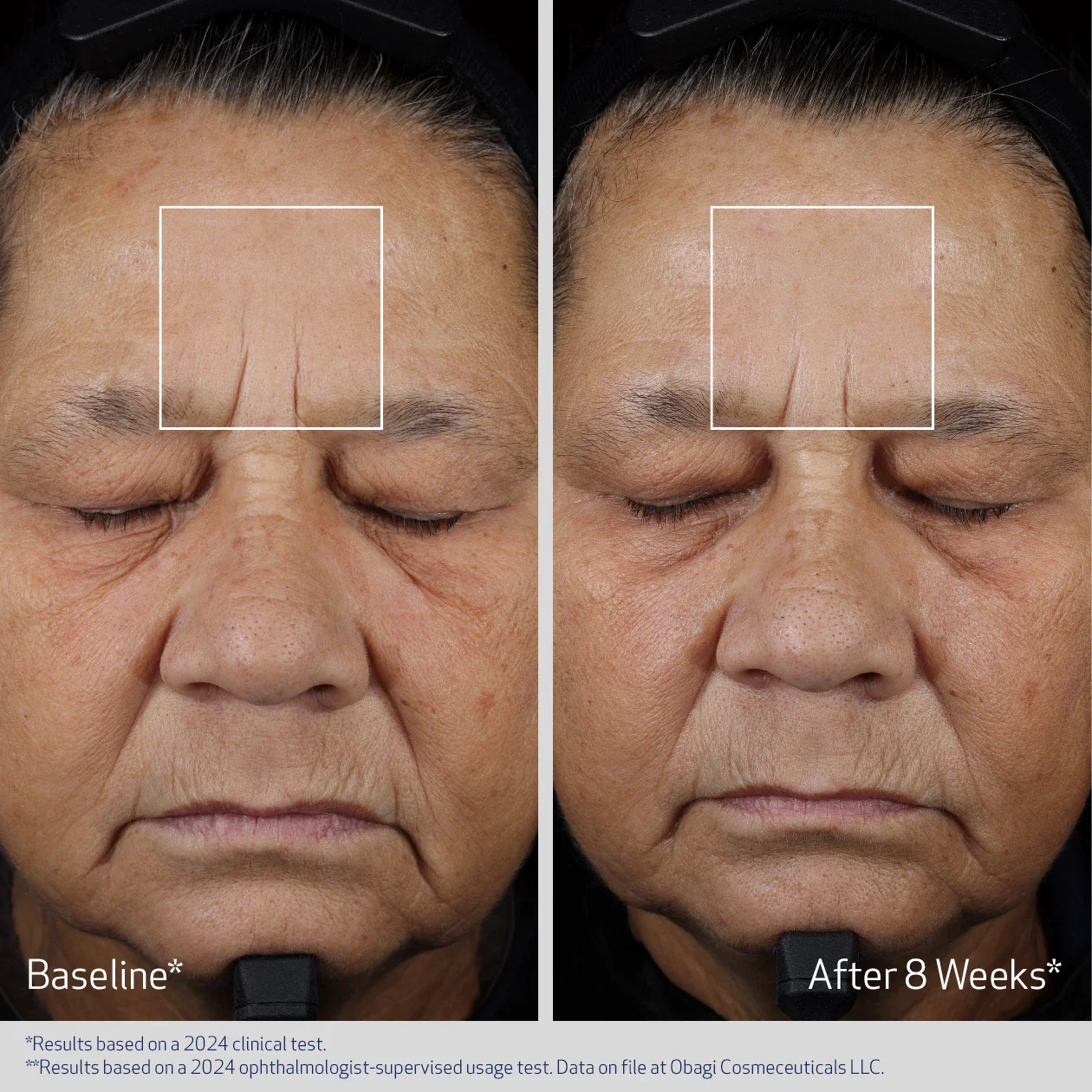 ADVANCED FILLER CONCENTRATE - Image 6