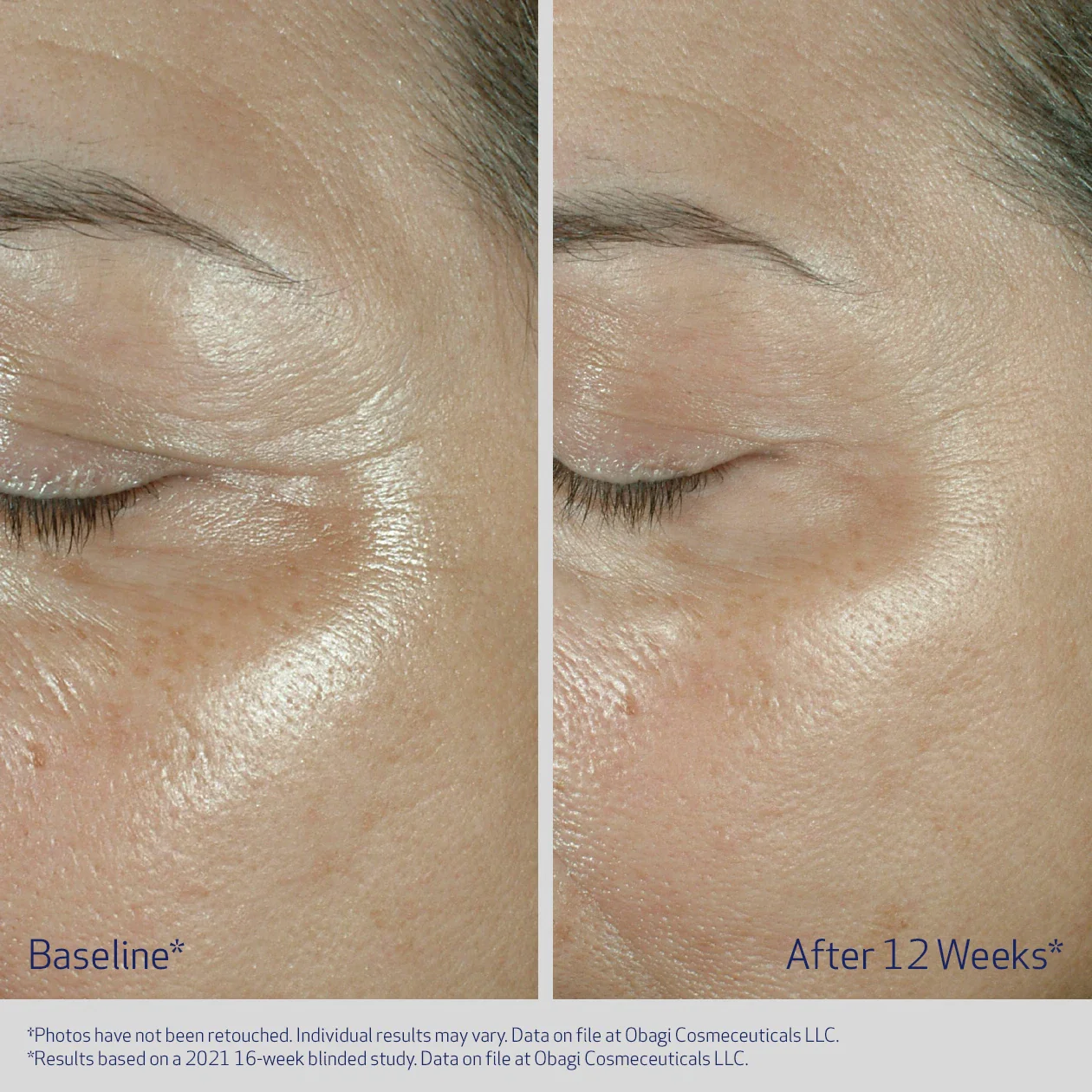 EYE CREAM - Image 5